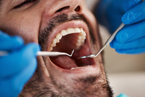 Best Emergency Dental Care for Broken or Chipped Teeth in Roebling, NJ
