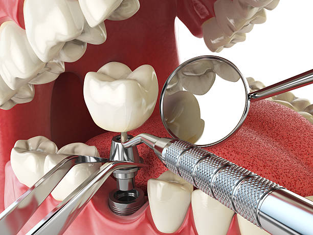 Best Emergency Treatment for Dental Infections or Abscesses in Roebling, NJ